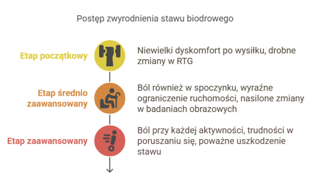 Czym jest zwyrodnienie stawu biodrowego i jakie są jego etapy?