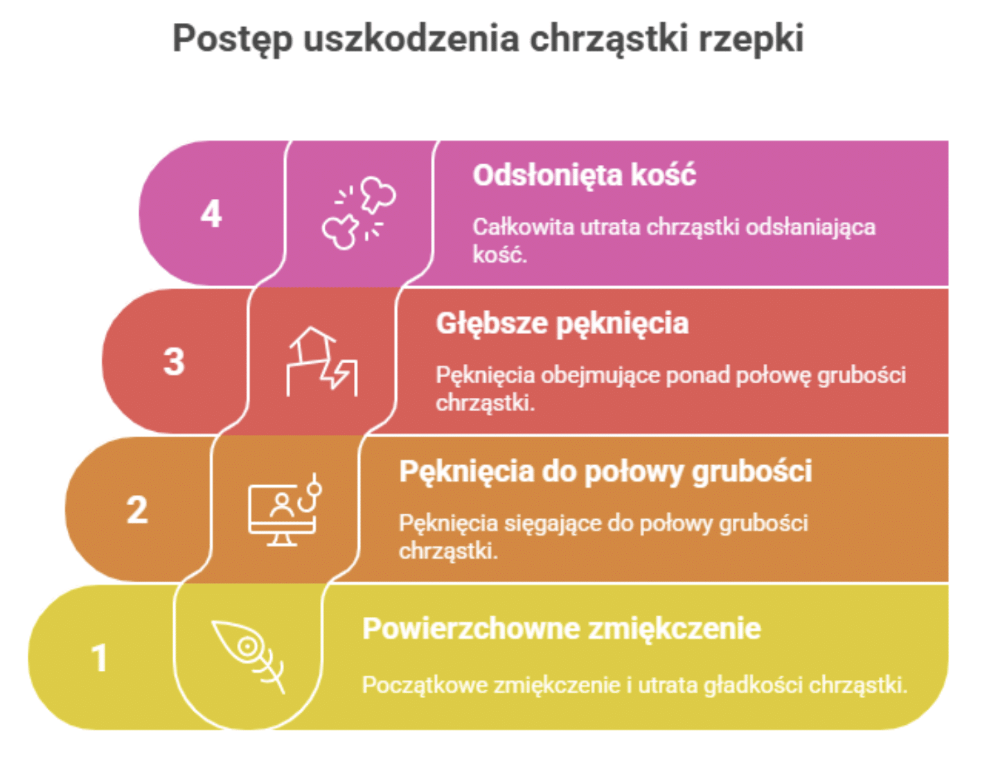 Stopnie zaawansowania chondromalacji według Outerbridge’a