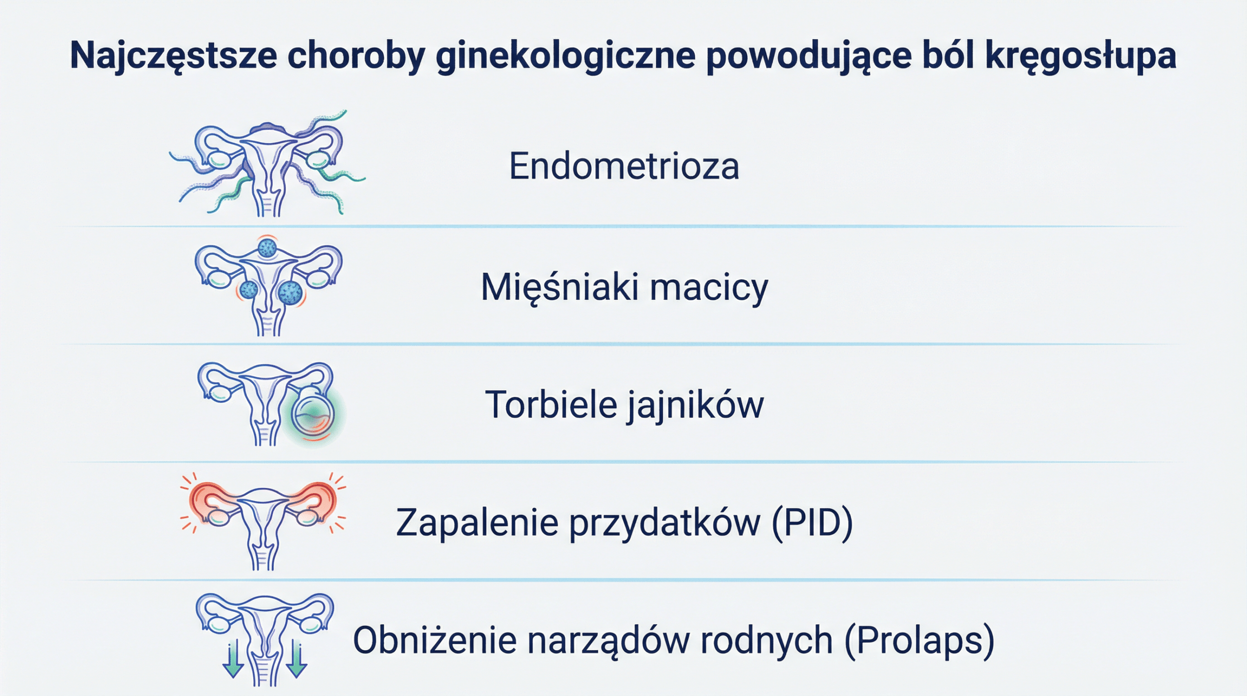 Najczęstsze choroby ginekologiczne powodujące ból kręgosłupa