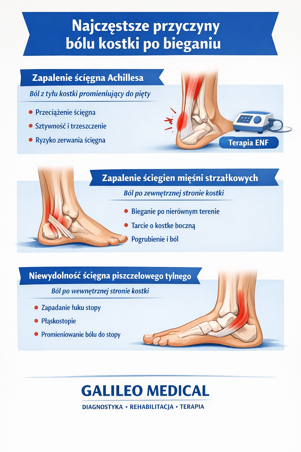 Najczęstsze przyczyny bólu kostki po bieganiu